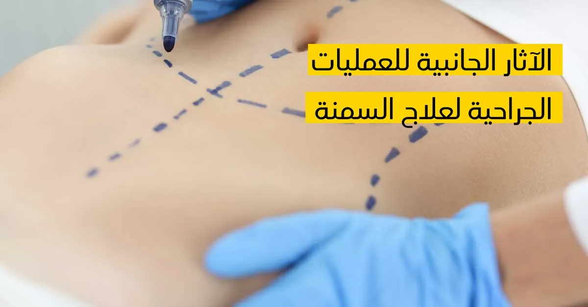 الآثار الجانبية للعمليات الجراحية لعلاج السمنة 